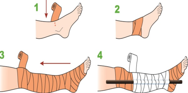 Cách sơ cứu những vết thương  do côn trùng đốt, động vật cắn