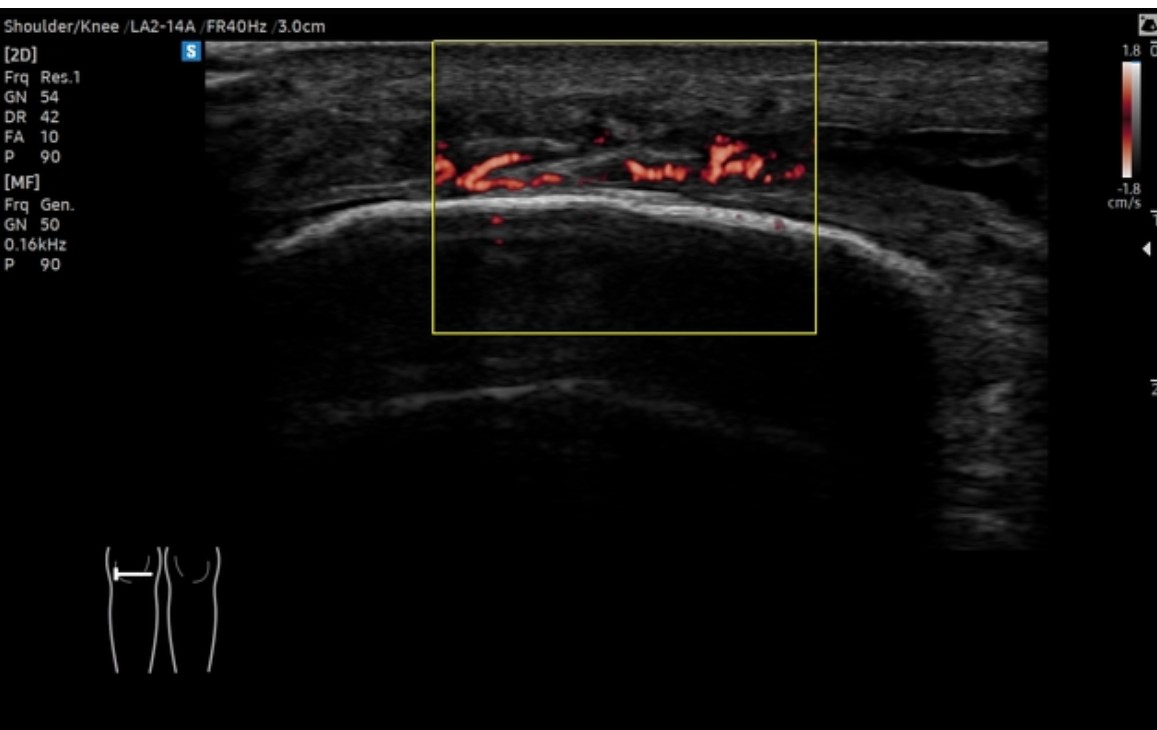 CÁC CÔNG NGHỆ XỬ LÝ HÌNH ẢNH MỚI TRÊN HỆ THỐNG SIÊU ÂM THÚ Y CAO CẤP